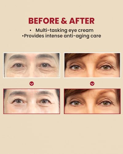 K-SECRET SEOUL 1988 Retinal Eye Cream – Formulated with Advanced Retinal Liposome 4% and Fermented Bean for Dark Circles and Fine Line Care | Korean Skincare, 30ml / 1.01 fl oz|B0DGGBYDRZ